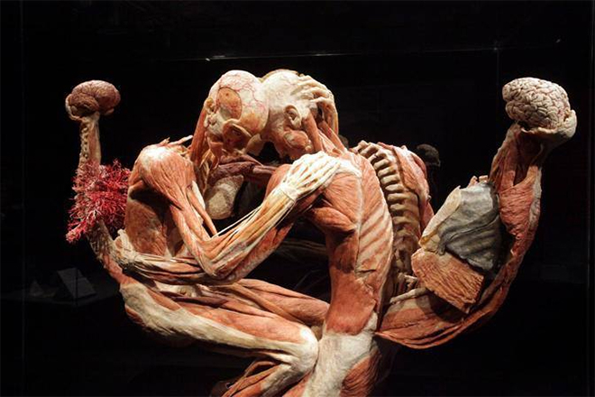 Body Worlds