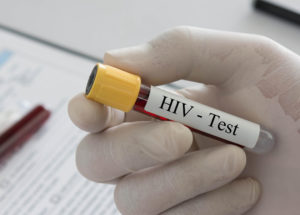 Aids e Hiv - una provetta per il test