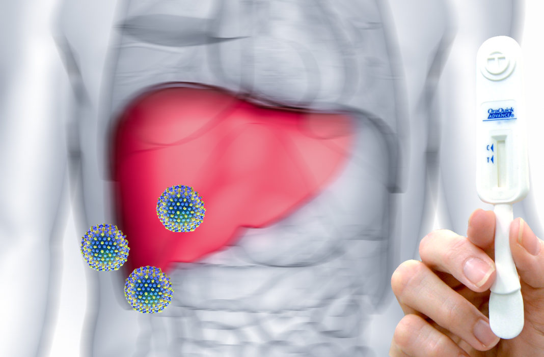 Virus hcv stilizzato con fegato e stick per esame della saliva per l'epatite c