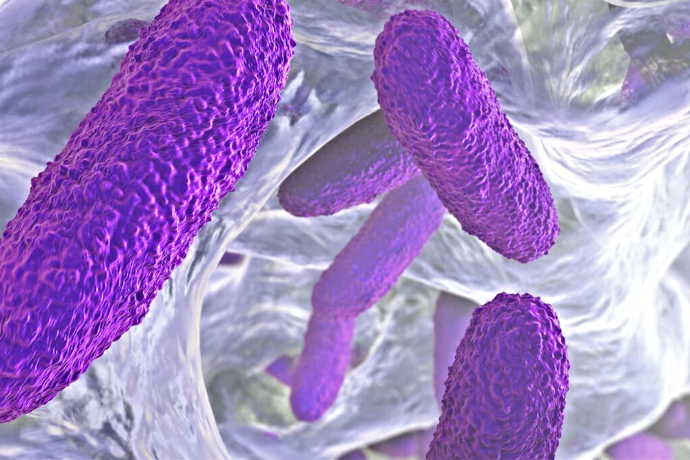 Klebsiella pneumoniae