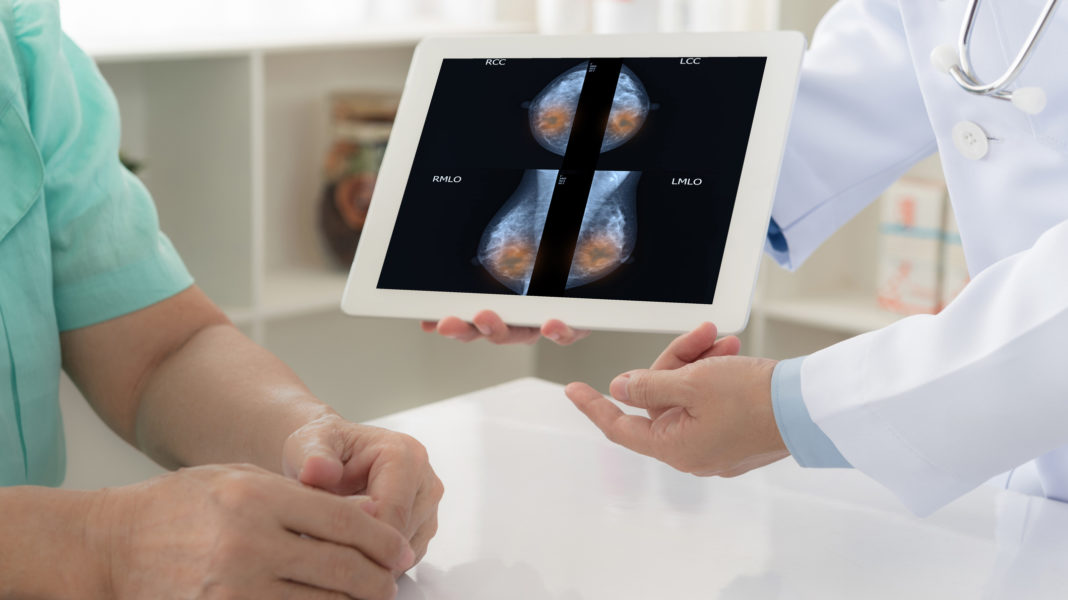 Cancro al seno