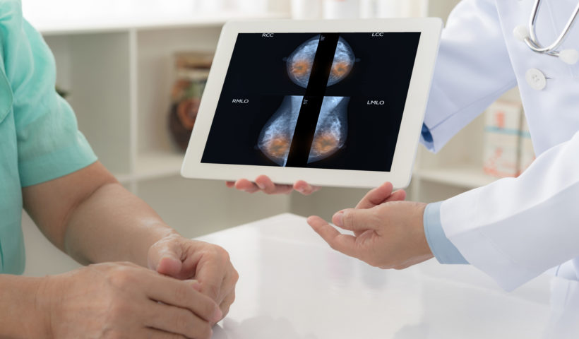 Cancro al seno