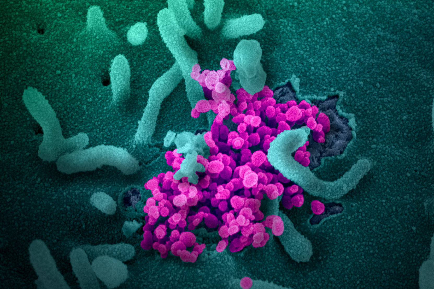 Coronavirus: NcoV (Niaid)