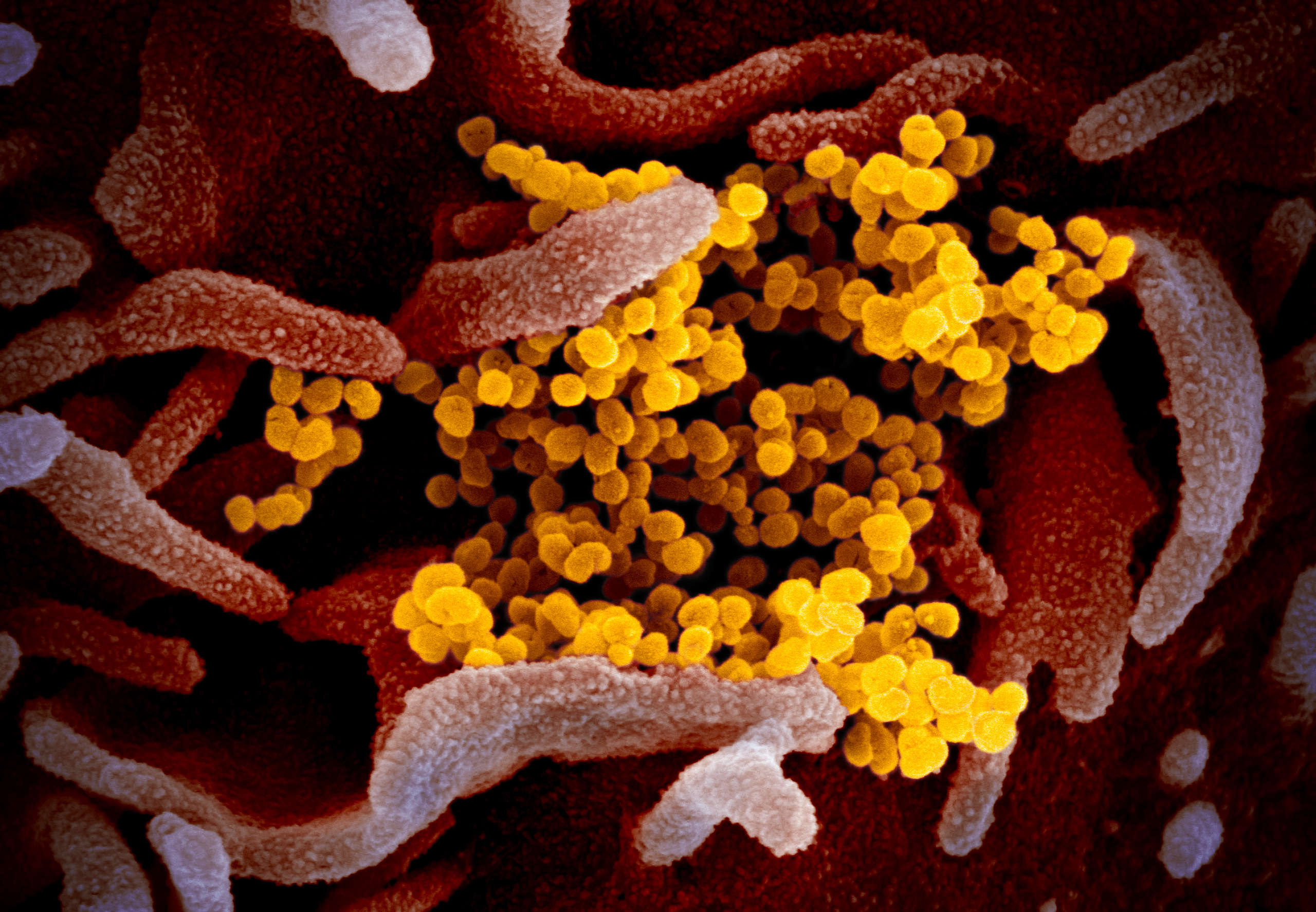 Coronavirus, la seconda ondata non ci sarà dice il premio Nobel