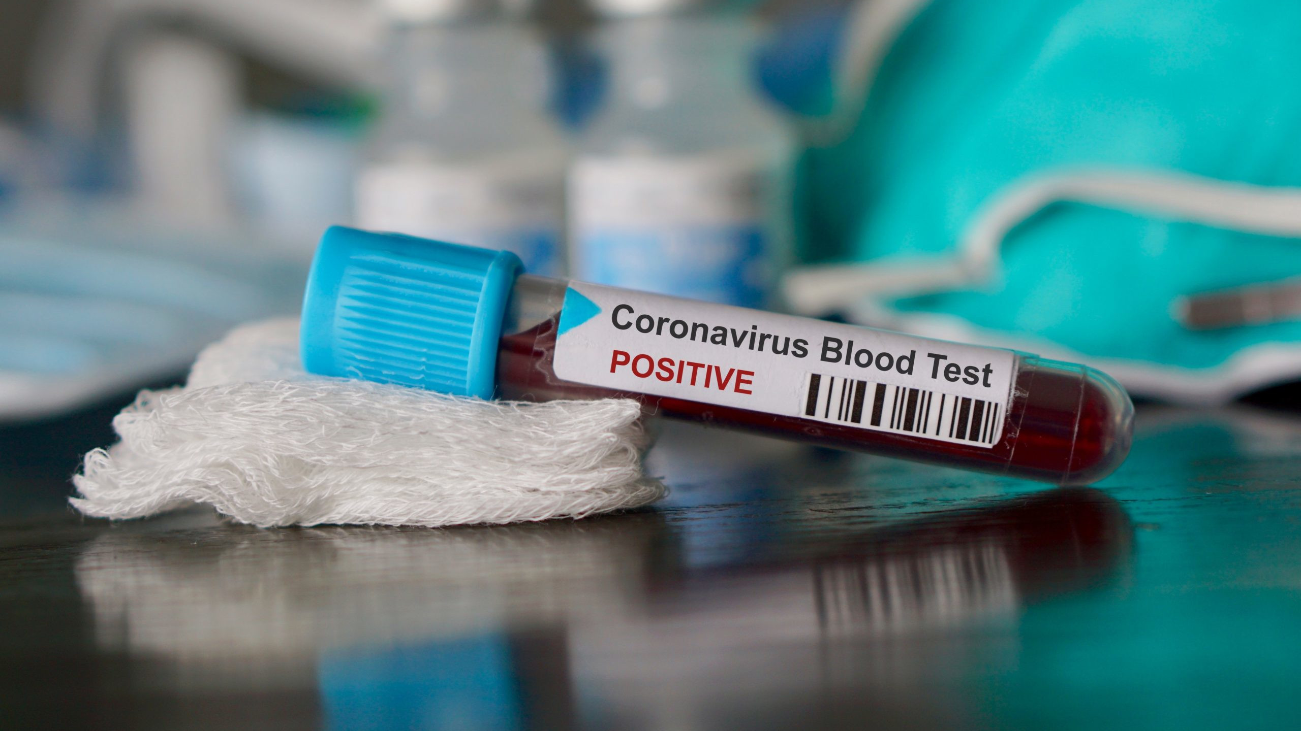 Provetta test coronavirus