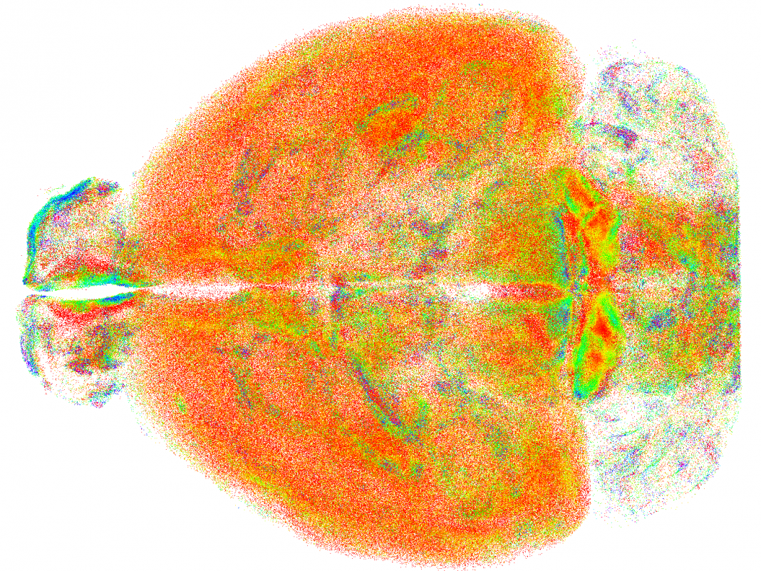Immagine del cervello