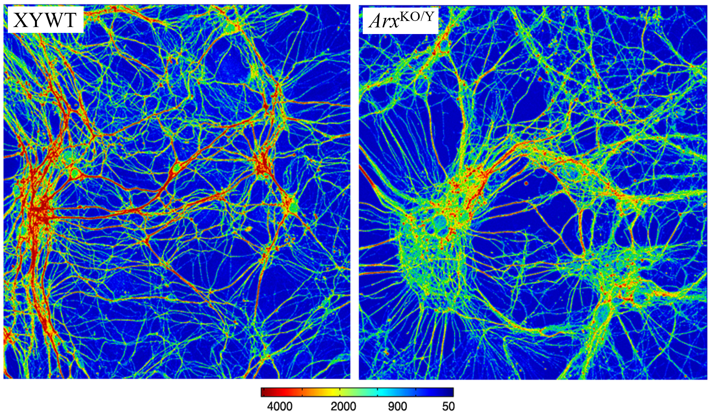 CNR: identificati i difetti molecolari di due patologie neurologiche