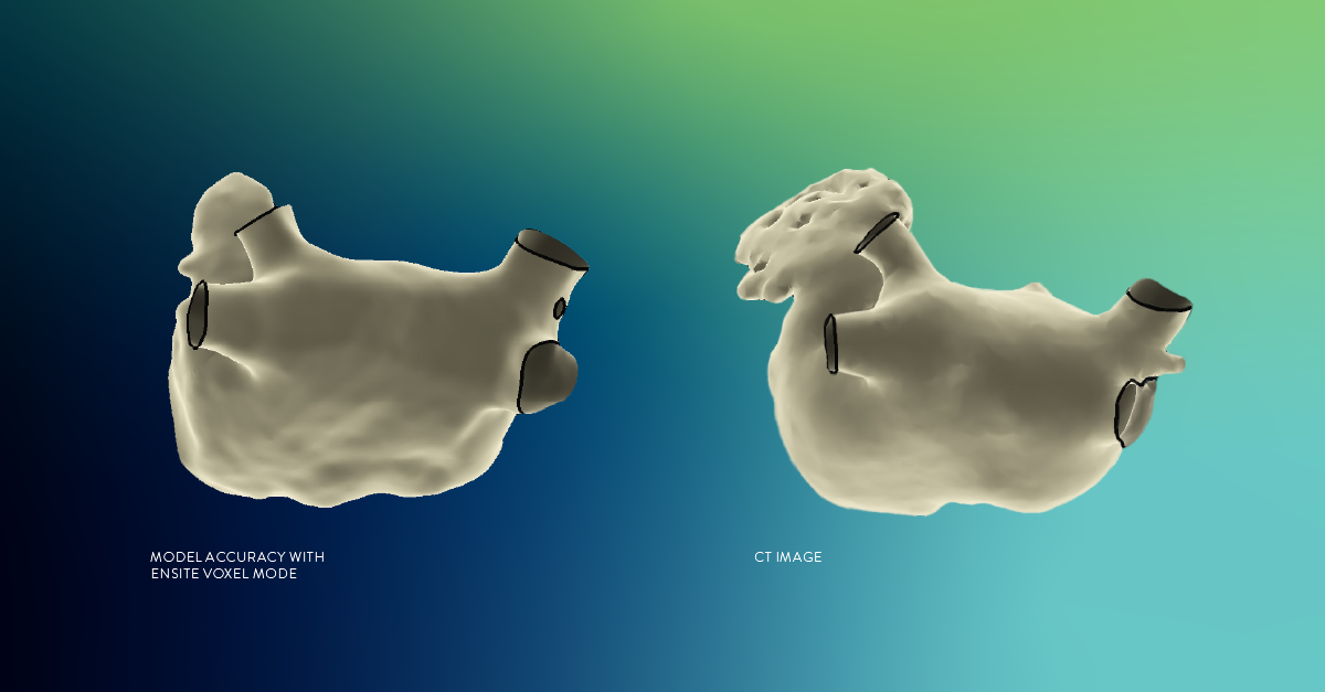 ensite x ep system ct vs voxel 1