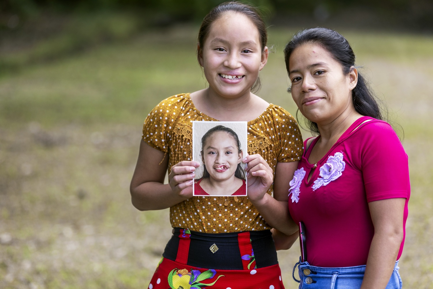 <strong>Festa della Mamma: Operation Smile celebra il coraggio di una madre con la Campagna “Il Suo Amore, il Suo Sorriso”</strong>