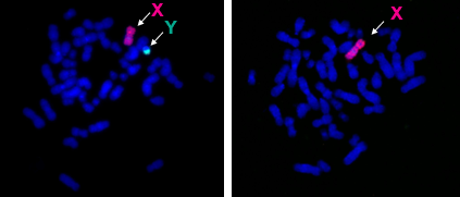 CNR. Medicina di genere: nuove informazioni sul “ruolo” del cromosoma Y